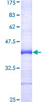 ab164531 on a 12.5% SDS-PAGE stained with Coomassie Blue.