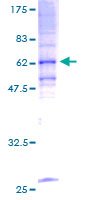ab161660 on a 12.5% SDS-PAGE stained with Coomassie Blue.