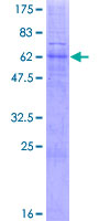 ab160614 on a 12.5% SDS-PAGE stained with Coomassie Blue.