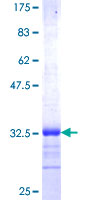 ab160615 on a 12.5% SDS-PAGE stained with Coomassie Blue.