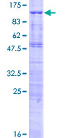 ab161488 on a 12.5% SDS-PAGE stained with Coomassie Blue.