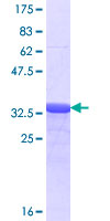 12.5% SDS-PAGE stained with Coomassie Blue showing ab116910 at approximately 37.73 kDa.