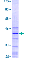 ab159754 on a 12.5% SDS-PAGE stained with Coomassie Blue.