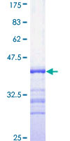 ab159673 on a 12.5% SDS-PAGE stained with Coomassie Blue.