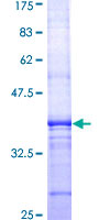 ab159687 on a 12.5% SDS-PAGE stained with Coomassie Blue.