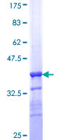ab160436 on a 12.5% SDS-PAGE stained with Coomassie Blue.