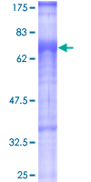 ab160467 on a 12.5% SDS-PAGE stained with Coomassie Blue.