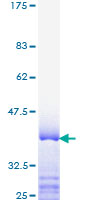 ab159163 on a 12.5% SDS-PAGE stained with Coomassie Blue.