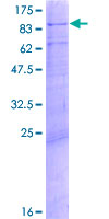 ab160487 on a 12.5% SDS-PAGE stained with Coomassie Blue.