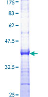 ab160488 on a 12.5% SDS-PAGE stained with Coomassie Blue.