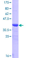 ab161341 on a 12.5% SDS-PAGE stained with Coomassie Blue.