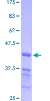 ab163236 on a 12.5% SDS-PAGE stained with Coomassie Blue.