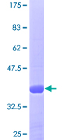 ab161265 on a 12.5% SDS-PAGE stained with Coomassie Blue.