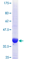 ab153061 on a 12.5% SDS-PAGE stained with Coomassie Blue.