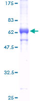 ab153298 on a 12.5% SDS-PAGE stained with Coomassie Blue.