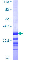 ab153299 on a 12.5% SDS-PAGE stained with Coomassie Blue.