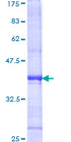 ab153605 on a 12.5% SDS-PAGE stained with Coomassie Blue.
