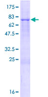 ab160676 on a 12.5% SDS-PAGE stained with Coomassie Blue.