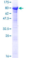 ab161081 on a 12.5% SDS-PAGE stained with Coomassie Blue.