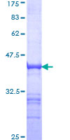 ab161082 on a 12.5% SDS-PAGE stained with Coomassie Blue.