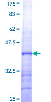 ab159870 on a 12.5% SDS-PAGE stained with Coomassie Blue.