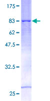 ab161281 on a 12.5% SDS-PAGE stained with Coomassie Blue.
