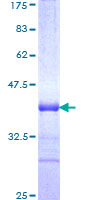 ab161282 on a 12.5% SDS-PAGE stained with Coomassie Blue.