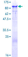 ab161486 on a 12.5% SDS-PAGE stained with Coomassie Blue.