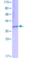 ab161487 on a 12.5% SDS-PAGE stained with Coomassie Blue.