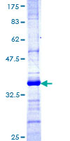 ab161529 on a 12.5% SDS-PAGE stained with Coomassie Blue.