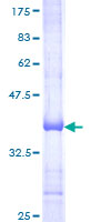 ab161009 on a 12.5% SDS-PAGE stained with Coomassie Blue.