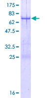 ab153383 on a 12.5% SDS-PAGE stained with Coomassie Blue.