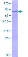 ab164841 on a 12.5% SDS-PAGE stained with Coomassie Blue.