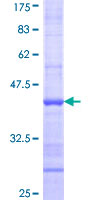 ab164842 on a 12.5% SDS-PAGE stained with Coomassie Blue.