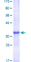 ab163475 on a 12.5% SDS-PAGE stained with Coomassie Blue.