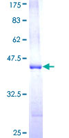 ab164745 on a 12.5% SDS-PAGE stained with Coomassie Blue.