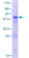 ab166390 on a 12.5% SDS-PAGE stained with Coomassie Blue.