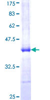 ab164371 on a 12.5% SDS-PAGE stained with Coomassie Blue.