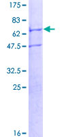 ab166233 on a 12.5% SDS-PAGE stained with Coomassie Blue.