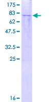 ab163023 on a 12.5% SDS-PAGE stained with Coomassie Blue.