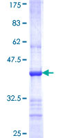 ab163024 on a 12.5% SDS-PAGE stained with Coomassie Blue.
