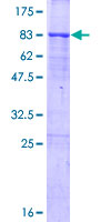 ab165884 on a 12.5% SDS-PAGE stained with Coomassie Blue.
