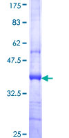 ab165885 on a 12.5% SDS-PAGE stained with Coomassie Blue.