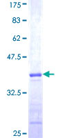 ab162969 on a 12.5% SDS-PAGE stained with Coomassie Blue.