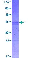ab165016 on a 12.5% SDS-PAGE stained with Coomassie Blue.