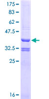 ab159748 on a 12.5% SDS-PAGE stained with Coomassie Blue.