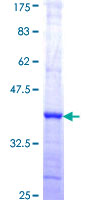 ab160425 on a 12.5% SDS-PAGE stained with Coomassie Blue.