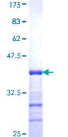 ab159749 on a 12.5% SDS-PAGE stained with Coomassie Blue.