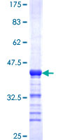 ab159750 on a 12.5% SDS-PAGE stained with Coomassie Blue.