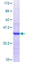 ab159016 on a 12.5% SDS-PAGE stained with Coomassie Blue.